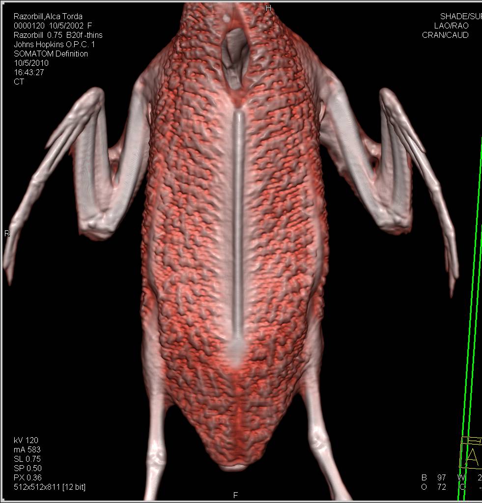 Razorbill in 3D without Pathology - CTisus CT Scan