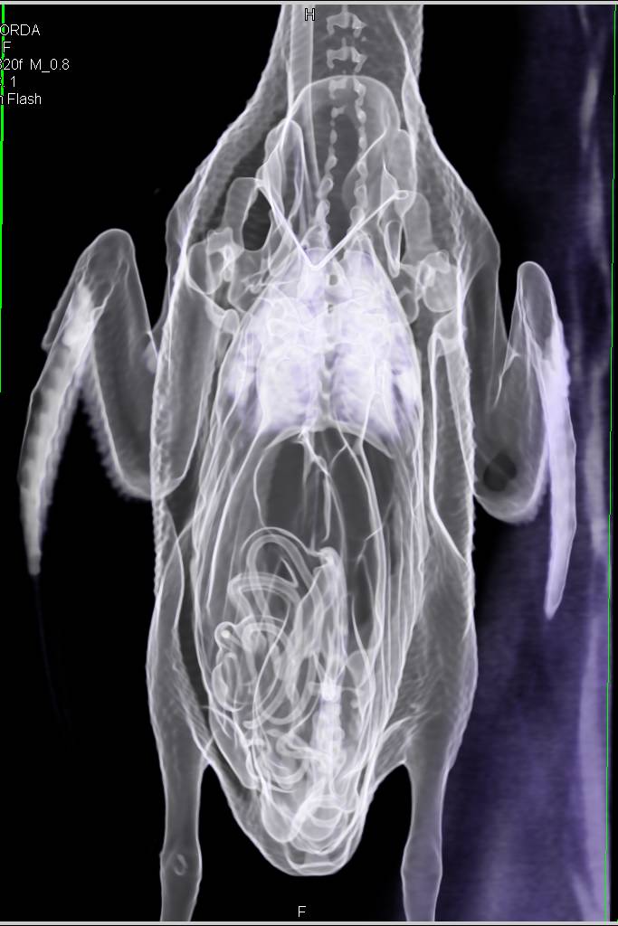 Razorbill with Failure to Thrive - CTisus CT Scan