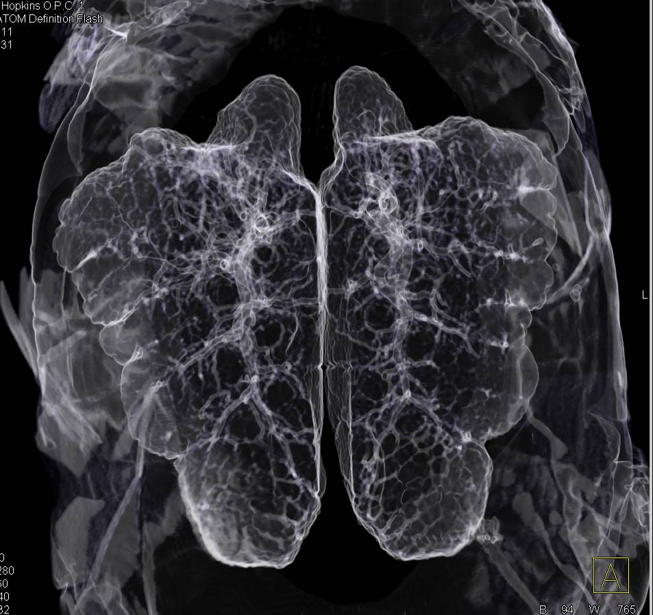 Air Sacs in a Turtle - CTisus CT Scan