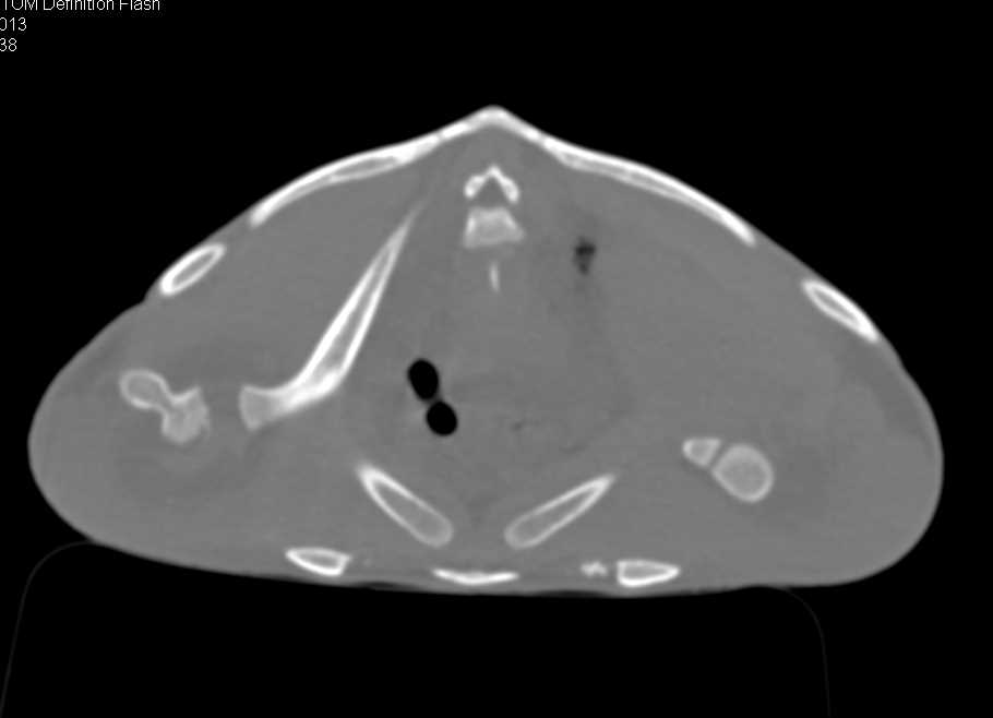 Sea Turtle with Degenerative Joint Disease (DJD) in Both Shoulders - CTisus CT Scan