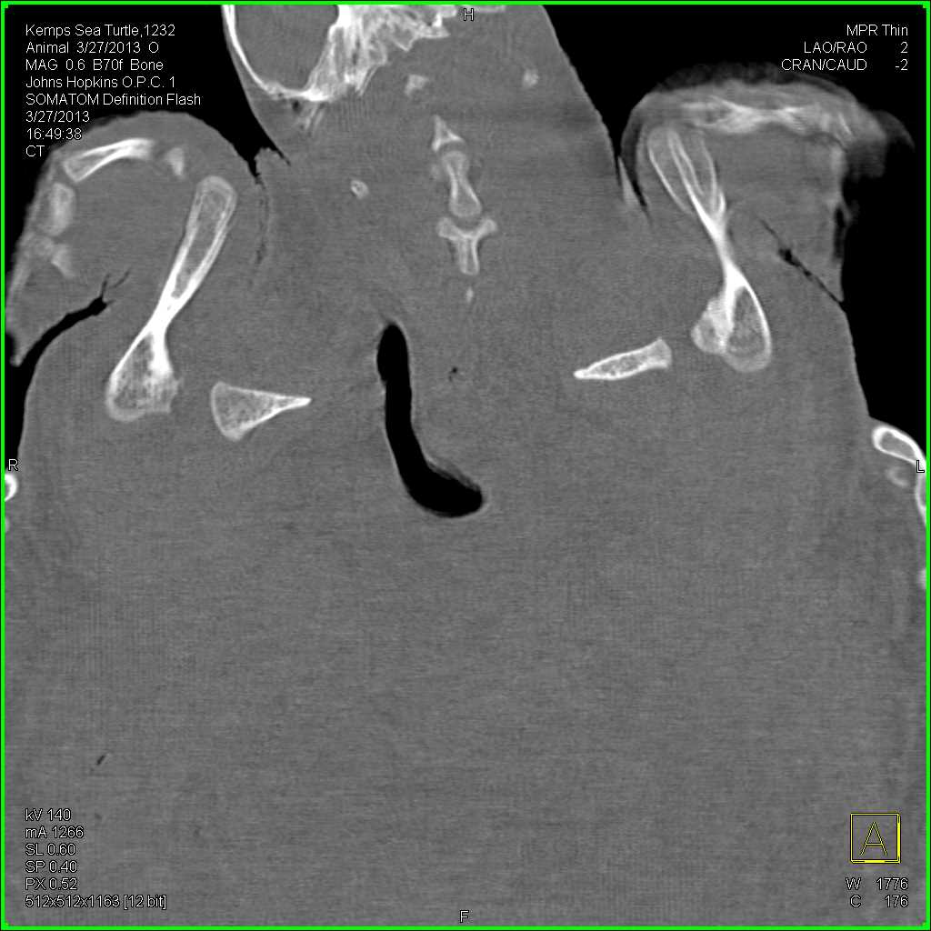 Kemps Sea Turtle - CTisus CT Scan