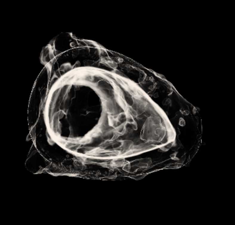 Artifact from Egypt Which is a Cats Head - CTisus CT Scan