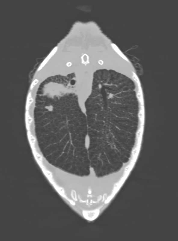 Ridley Turtle Without Complications - CTisus CT Scan