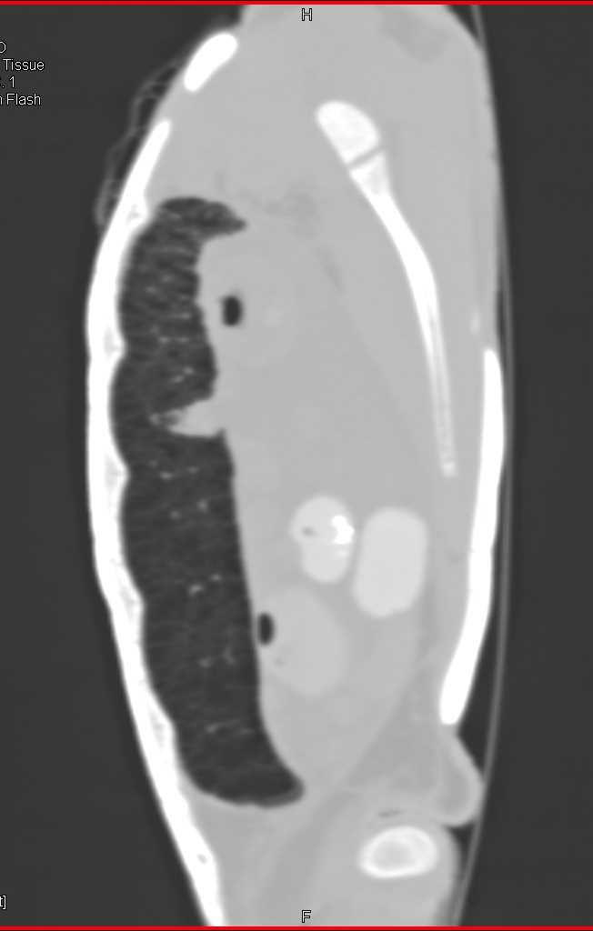 Ridley Turtle Without Complications - CTisus CT Scan