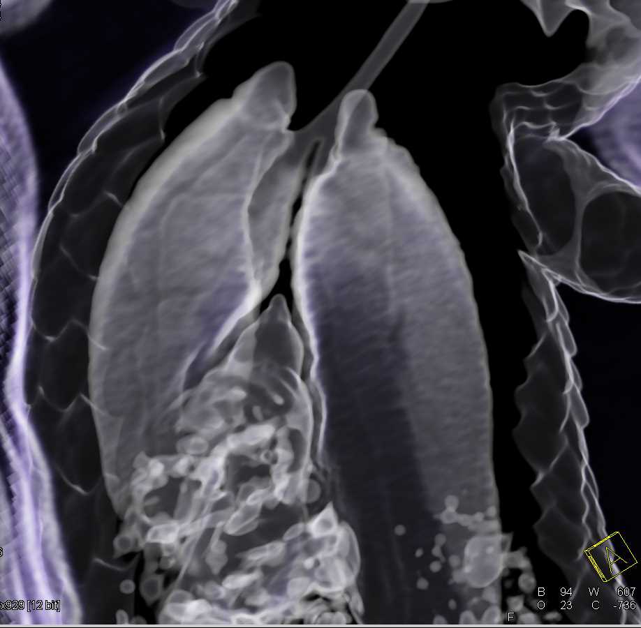 Blue-tailed Skink - CTisus CT Scan