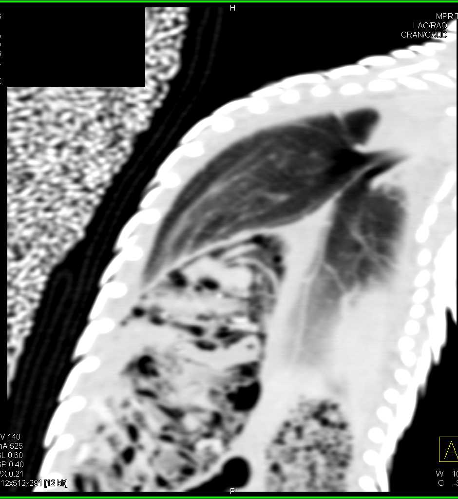 3D Imaging of a Blue-Tongue Skink - CTisus CT Scan