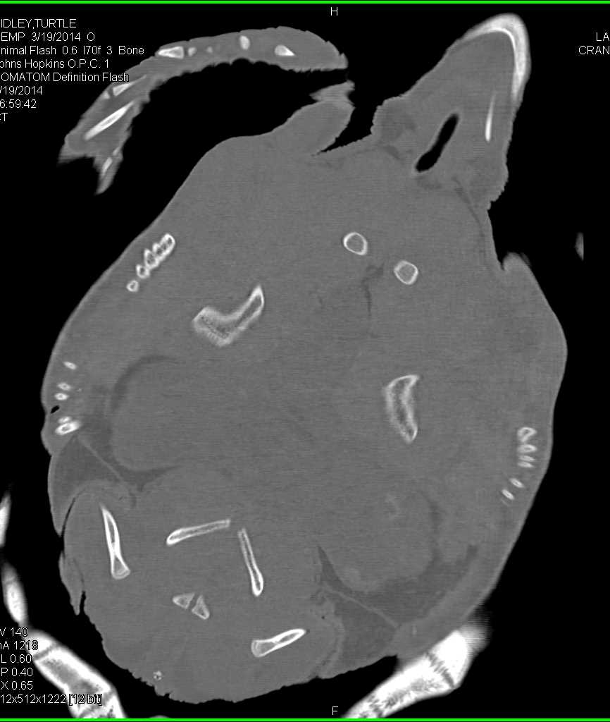 Ridley Turtle with Osteomyelitis Proximal Right Humerus - CTisus CT Scan