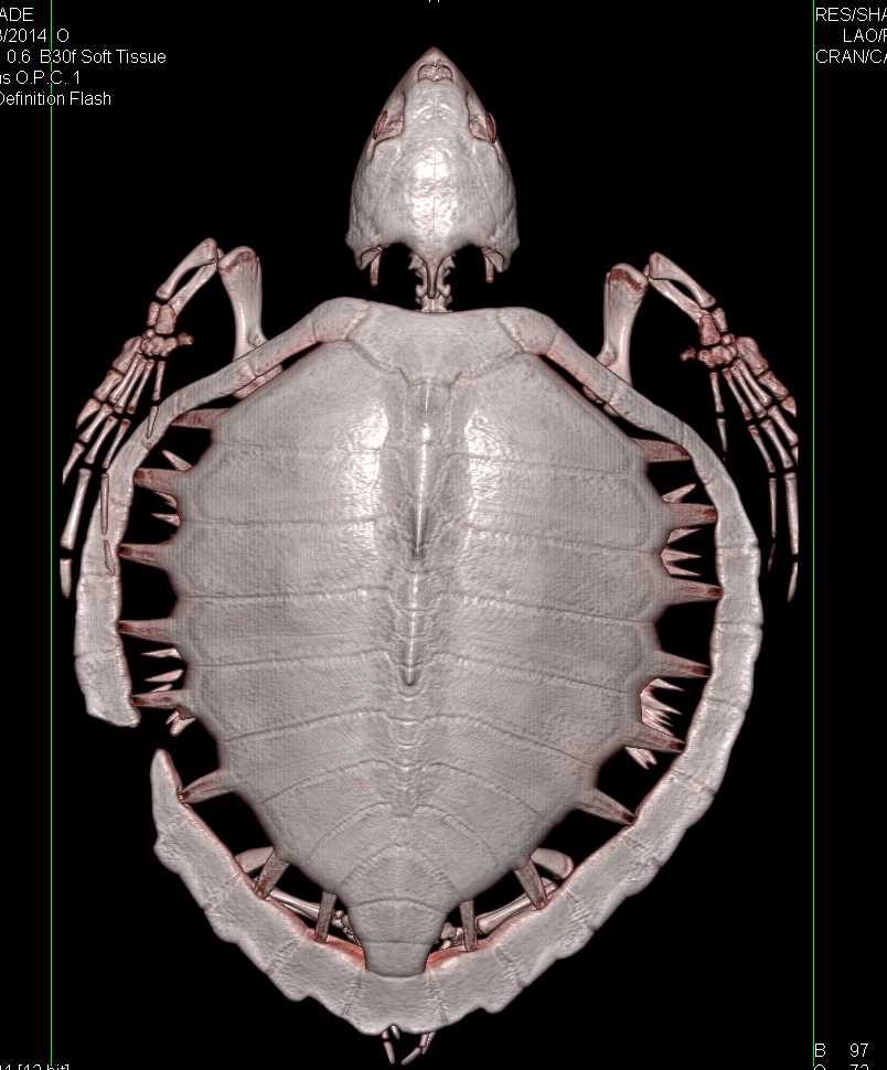 Turtle with Healed Zone of Prior Osteomyelitis of the Shell with Debridement - CTisus CT Scan