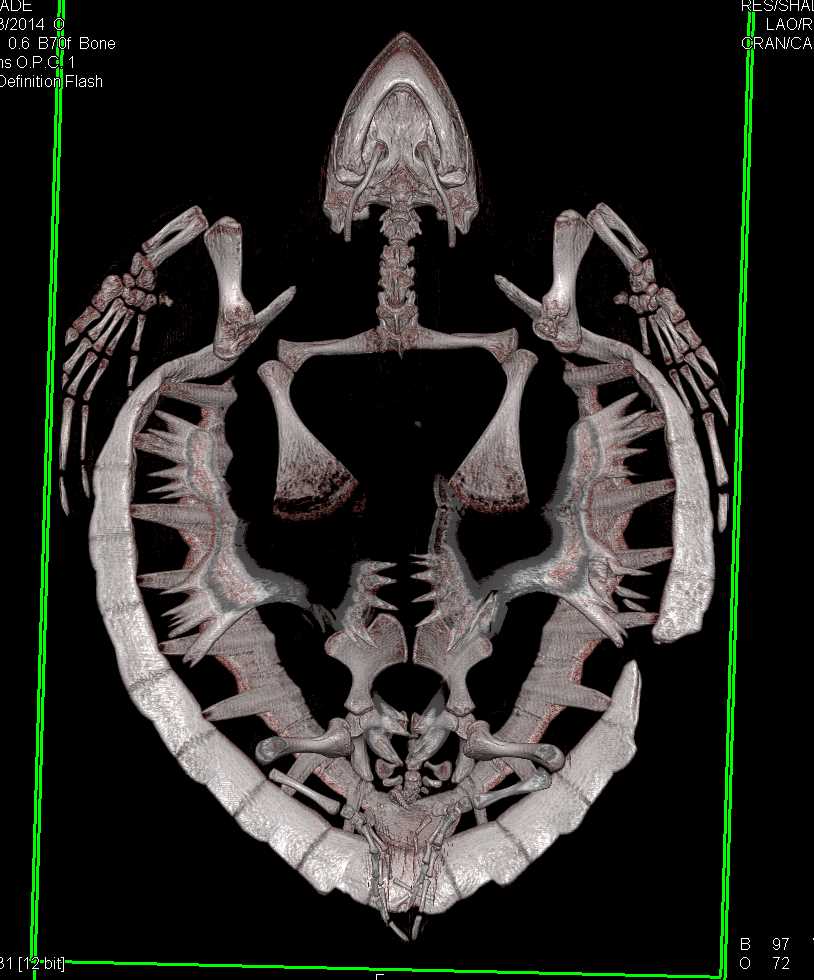 Turtle with Healed Zone of Prior Osteomyelitis of the Shell with Debridement - CTisus CT Scan