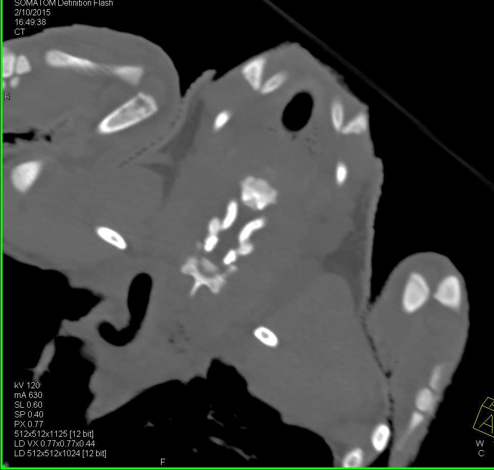 Osteomyelitis Right Humerus in a Turtle - CTisus CT Scan