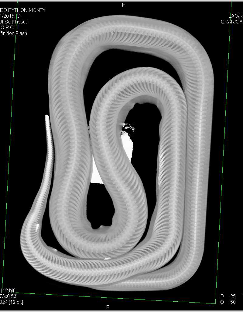 Python by the Name of Monty - CTisus CT Scan