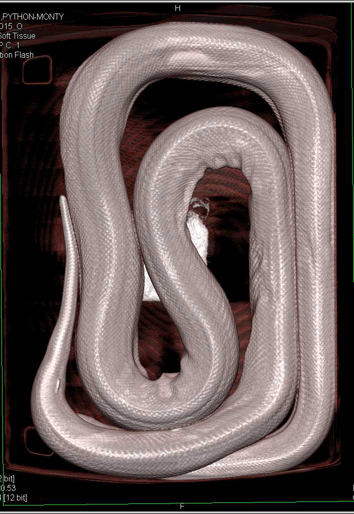 Python by the Name of Monty - CTisus CT Scan