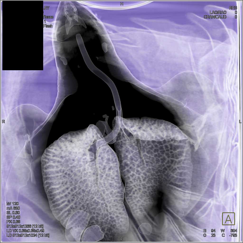 Ridley Turtle with Dilated Esophagus - CTisus CT Scan