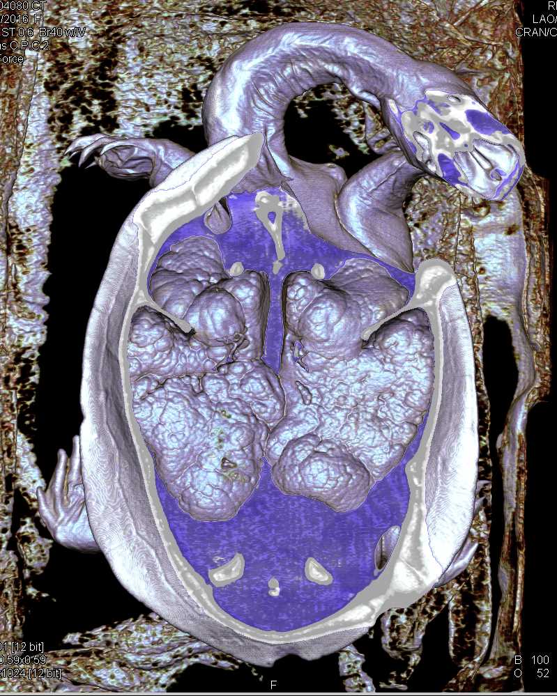 Normal Lung and Airways of  a turtle - CTisus CT Scan