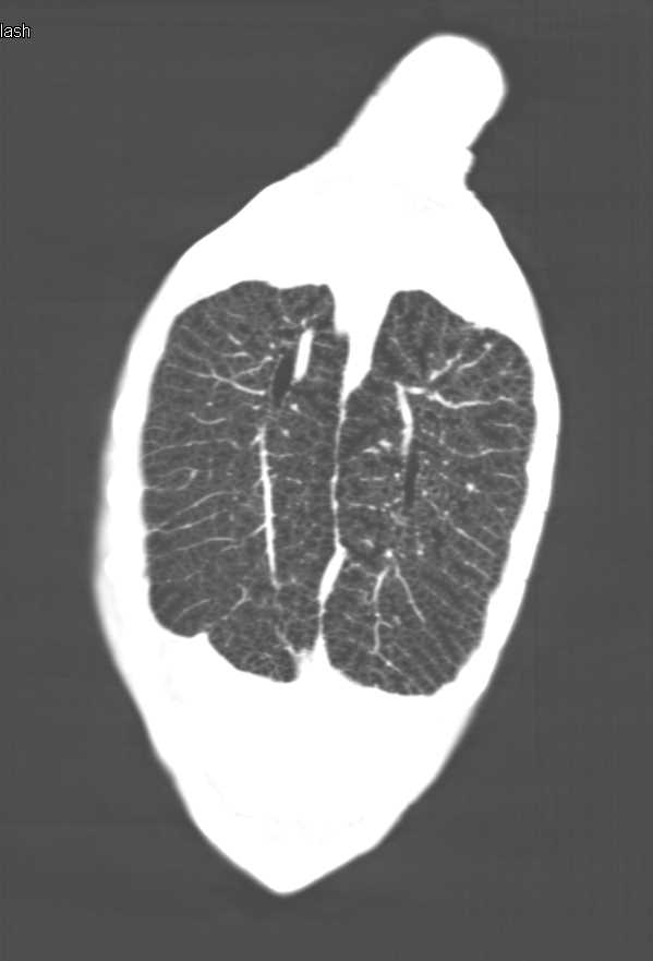 Pulmonary Anatomy in a Turtle - CTisus CT Scan