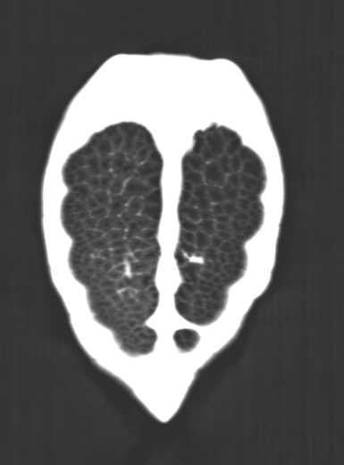 Turtle Without Pneumonia - CTisus CT Scan