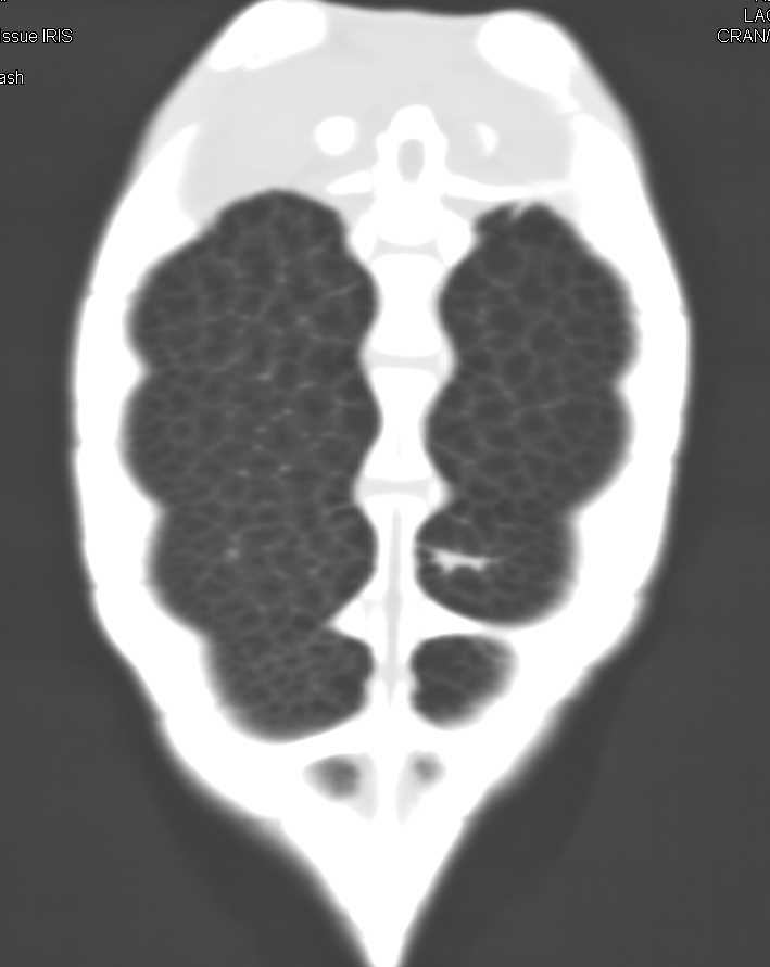 Turtle Without Pneumonia - CTisus CT Scan