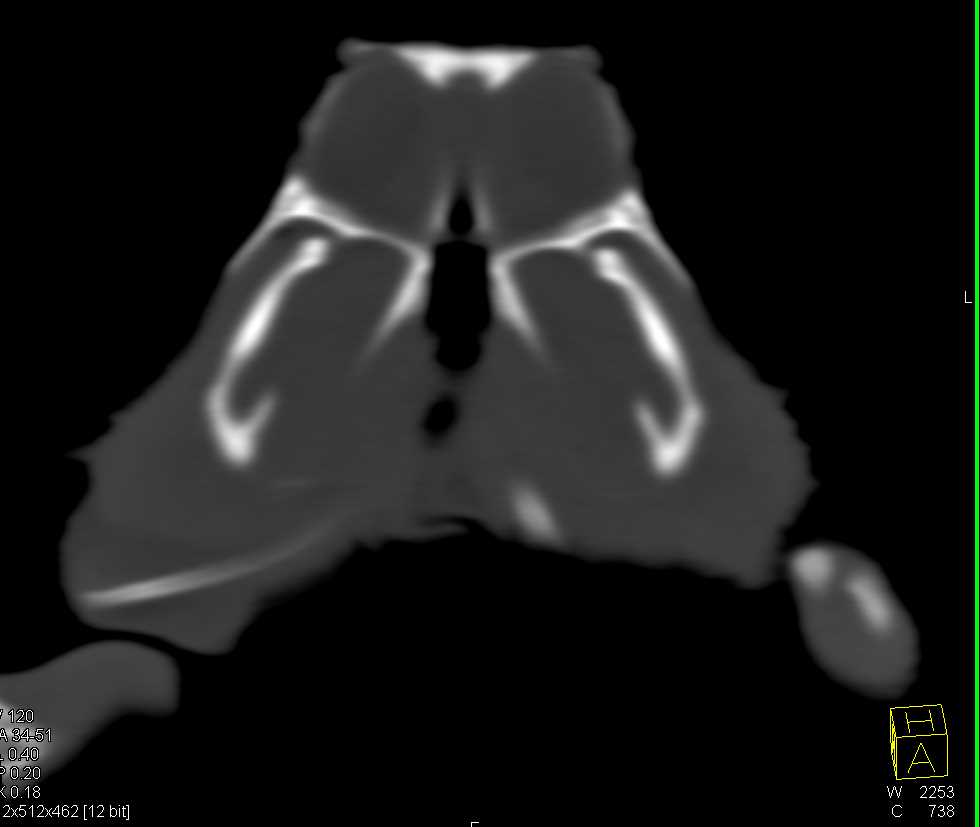 Bearded Dragon - CTisus CT Scan