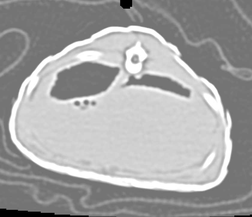 Shingleback Skink - CTisus CT Scan