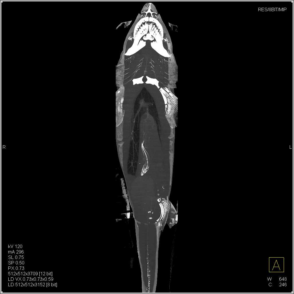 Sand Tiger Shark that ate a Fish - CTisus CT Scan