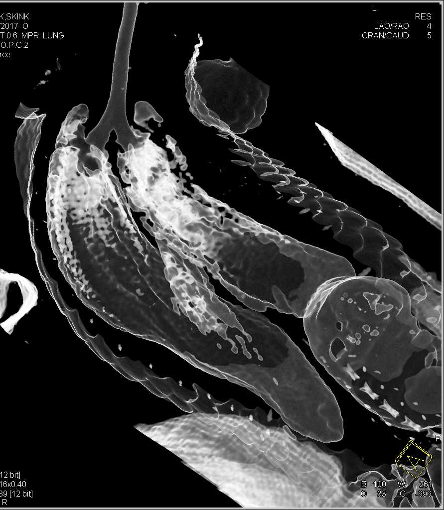 3D of a Skink - CTisus CT Scan