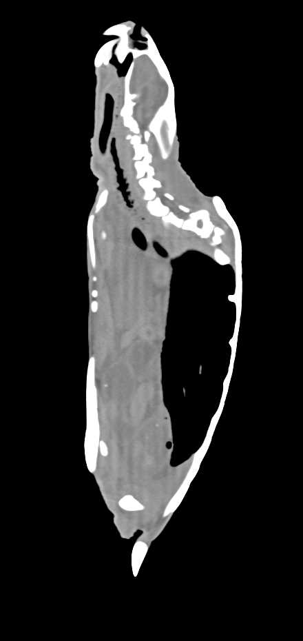Normal Turtle in 3D - CTisus CT Scan