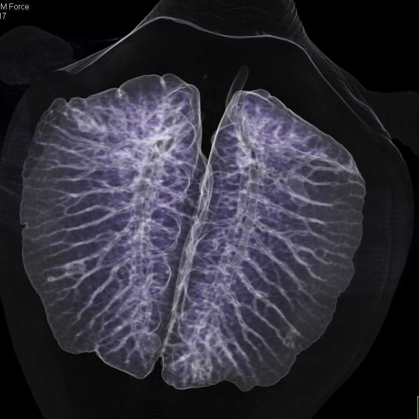 Normal Turtle in 3D - CTisus CT Scan