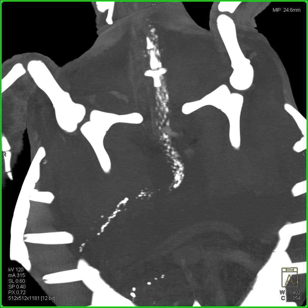 Turtle with Esophagitis - CTisus CT Scan