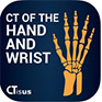 CTisus: CT of the Hand and Wrist